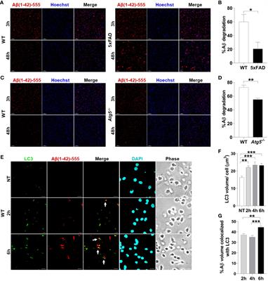 Elevated Expression of MiR-17 in Microglia of Alzheimer’s Disease Patients Abrogates Autophagy-Mediated Amyloid-β Degradation